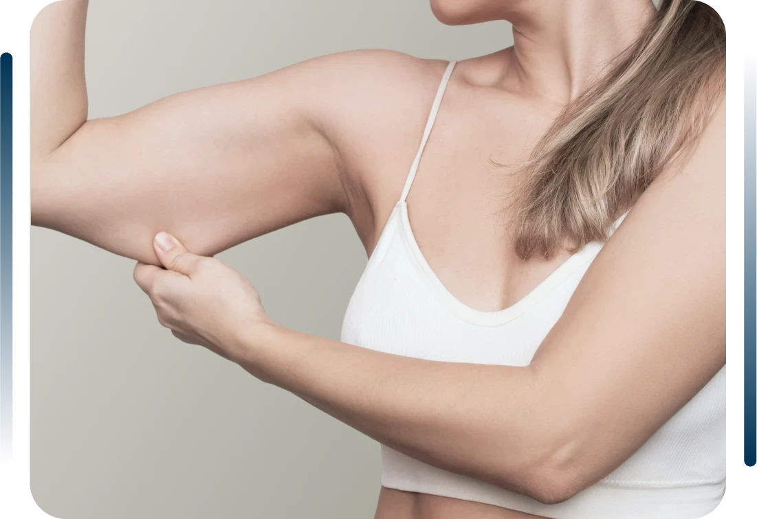 Cirurgia Pl&aacute;stica P&oacute;s-Emagrecimento <br />em Ribeir&atilde;o Preto com Dr. Rodrigo Rosique