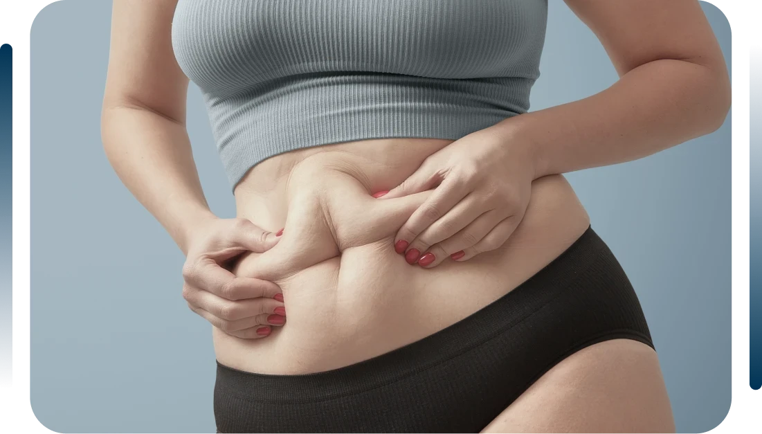 O que &eacute; a abdominoplastia?