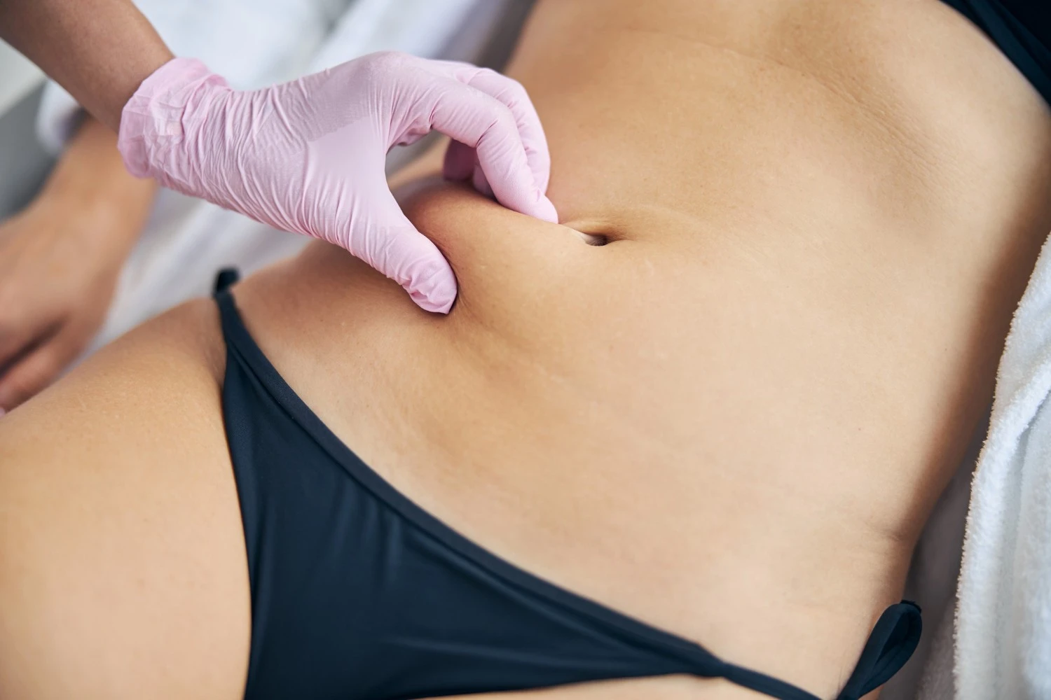 O que torna uma abdominoplastia 