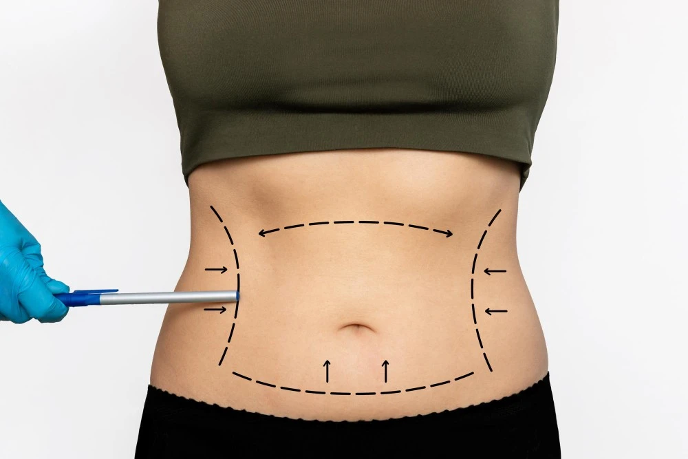 Para quem as cirurgias de contorno corporal s&atilde;o indicadas?