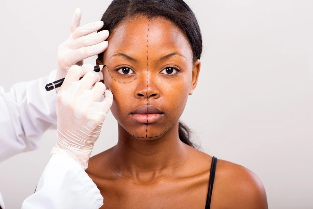 Lifting de face para apar&ecirc;ncia cansada: quando a cirurgia realmente ajuda?