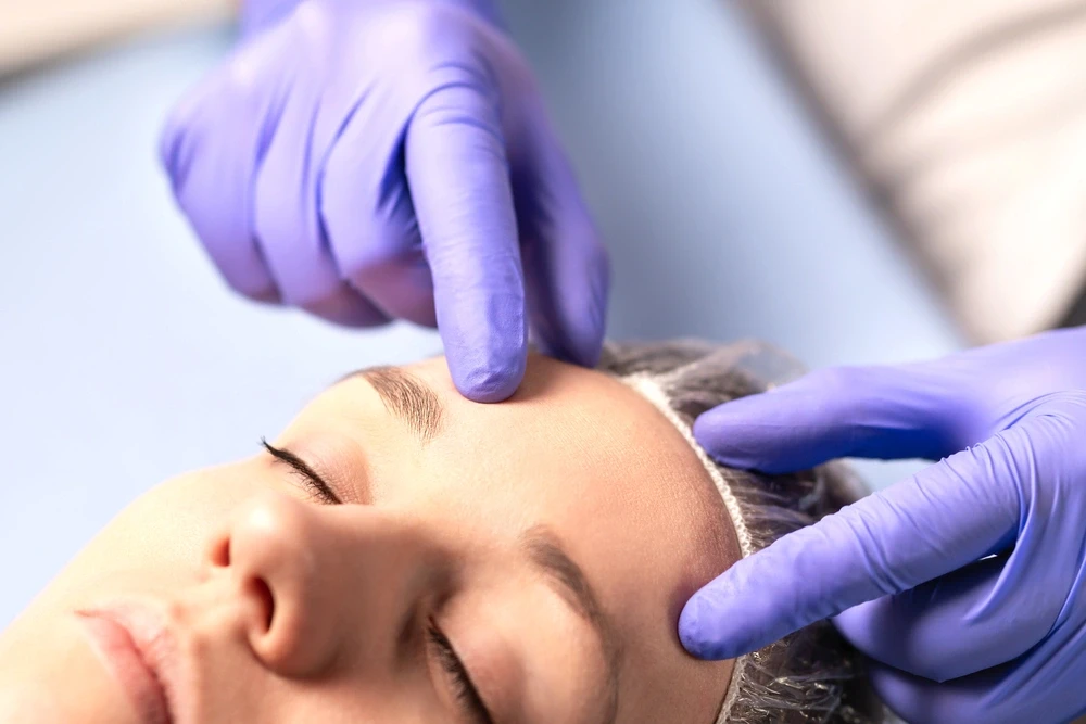 Quanto tempo dura o resultado do lifting facial?