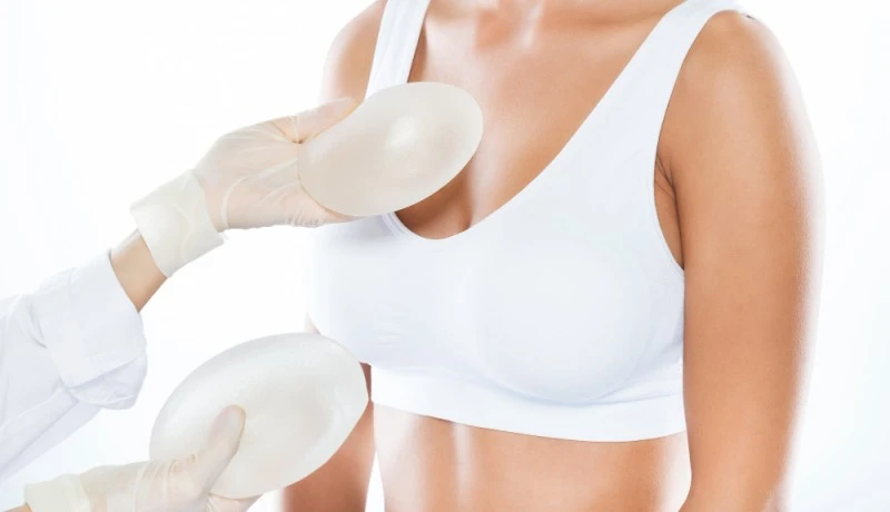 Mamoplastia em Ribeirão Preto: saiba como o procedimento pode transformar a autoestima