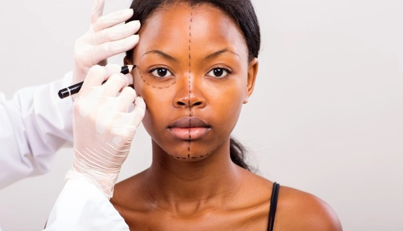 Lifting de face para aparência cansada: quando a cirurgia pode ajudar?