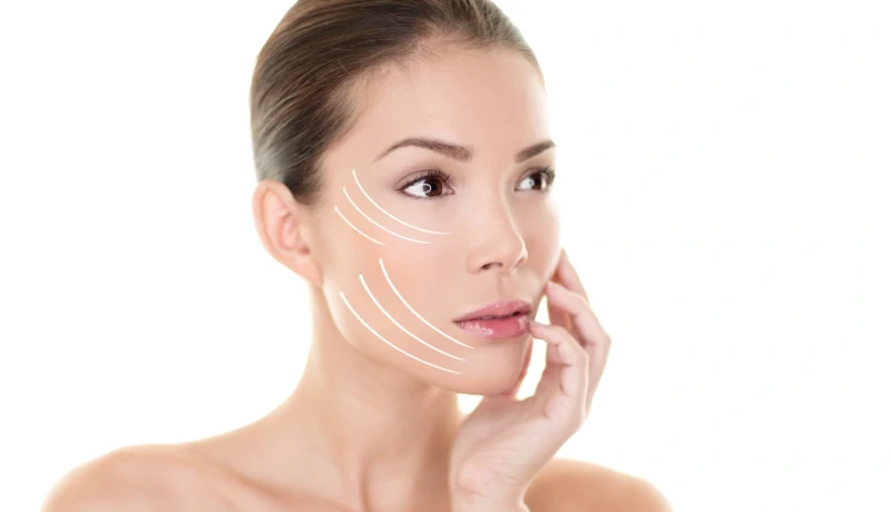 Lifting de face: como funciona, quanto tempo dura a cirurgia e como é o pós-operatório?